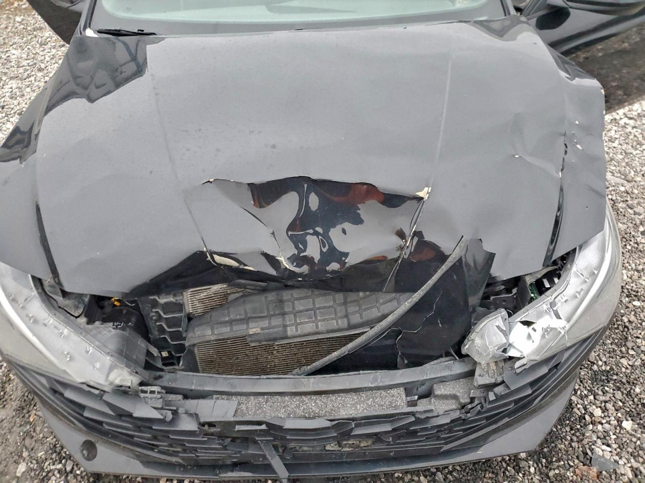 Hyundai ELANTRA Se Image 4